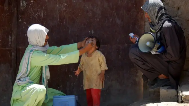 د عامې روغتیا وزارت وايي، د جولای میاشتې له ګوزڼ ضد کمپاینه ۹۸۶ زره ماشومان بې برخې پاتې کېږی.