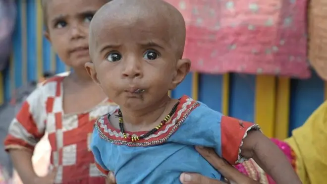 بچے بیماریاں