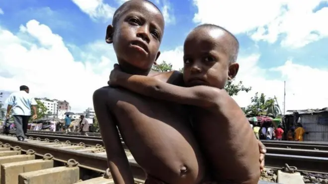 현재 전 세계 5세 미만 어린이 2억 명이 영양 결핍을 앓고 있다