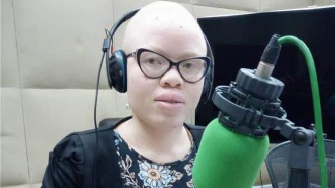 Khadija Maarufu, une albinos et étudiante tanzanienne, s'est confiée à la BBC à l'occasion de la célébration de la Journée internationale de sensibilisation à l'albinisme.
