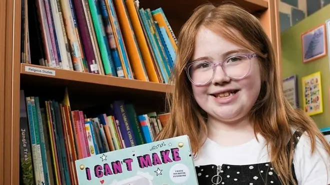 „Živeti s Turetovim sindromom je teško, ali mi se tome smejemo“