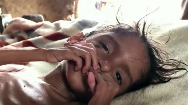 خمس سنوات من الجوع وخمس سنوات من النزاع