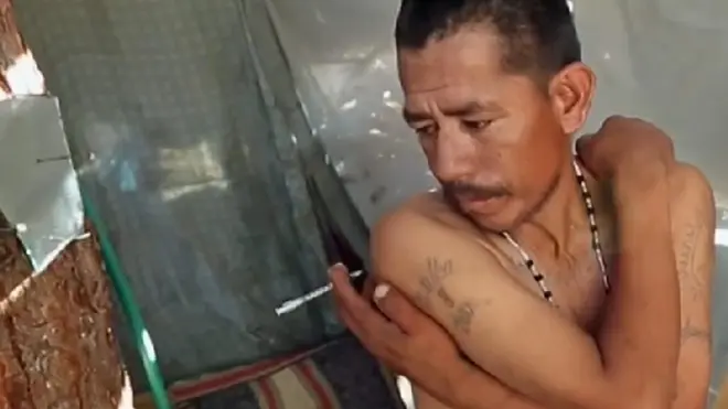 Un hombre se inyecta mexicana