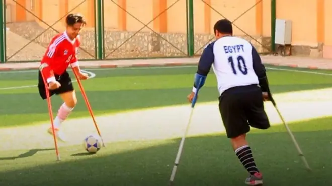 فريق كرة قدم" بساق واحدة"