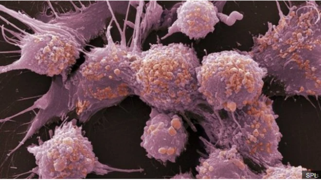 เซลล์มะเร็งต่อมลูกหมาก