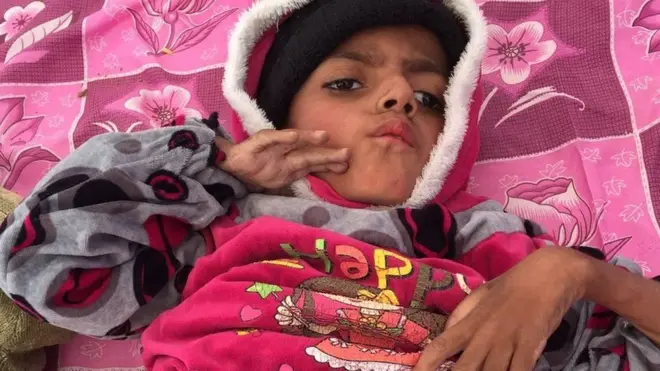 تقول أم الطفل البالغ من العمر تسع سنوات إن تنظيم الدولة الإسلامية تجاهل مناشداتها لعلاجهم