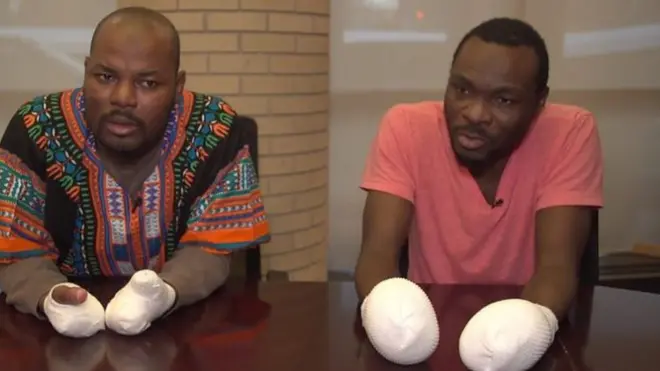 Разак Лайал (слева) потерял пальцы на американо-канадской границе