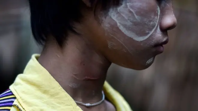 Gabdhaha ayaa hadda ku soo kabanaya deegaankii ay ka yimaadeen, mana cadda waxa uu mustaqbalkoodu noqon doono