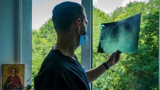 Doktor i rendgenski snimak