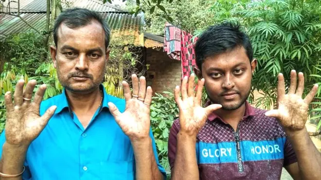 අමල් සර්කර් සහ අපු සර්කර්