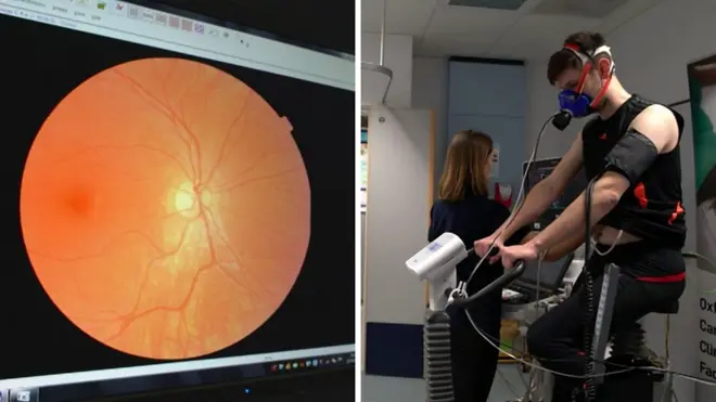 كيف تؤثر ظروف الحمل على مستقبلنا الصحي؟