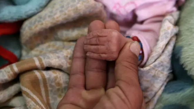 زاد فيروس كورونا من معاناة اليمنيين الذين يعيش الملايين منهم على حافة الجوع