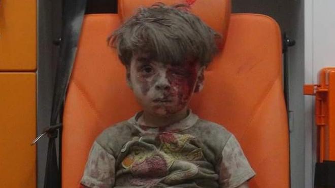 Photo published by opposition activist group, Aleppo Media Centre, showing boy it says was injured in air strike in Qaterji, Aleppo, on 17 August 2016