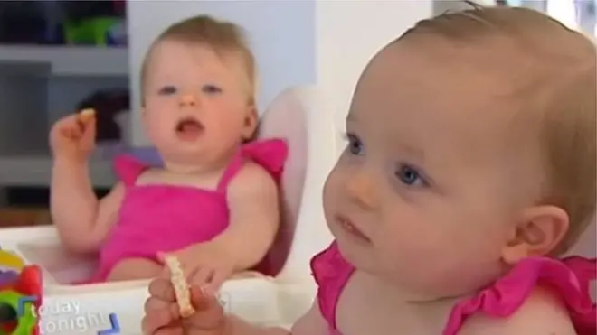 Hai bé Charlotte và Olivia Hill sinh cùng ngày nhưng được thụ thai cách nhau 10 ngày
