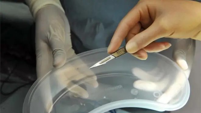 تزدهر تجارة الأعضاء البشرية في الصين وتوجد سوق سوداء لذلك