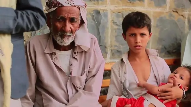 الكوليرا في اليمن