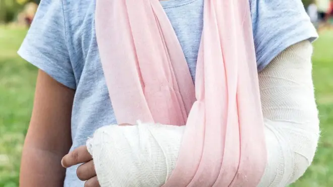 Перелом руки