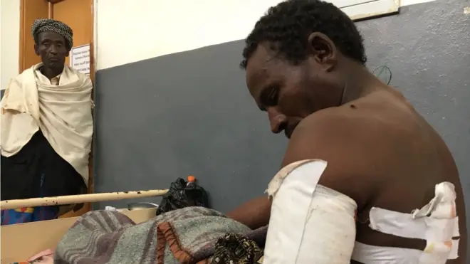 Obbo Biduu Dhaddachaa, walitti bu'iinsa aanaa Areerootti uummameen miidhamanii hospitaala Yaaballootti wal'aansi taasifamaafii jira