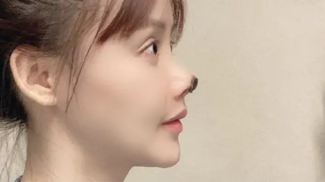 Gao Liu's nose has been damaged