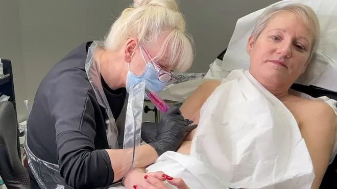 Tetoviranje bradavica