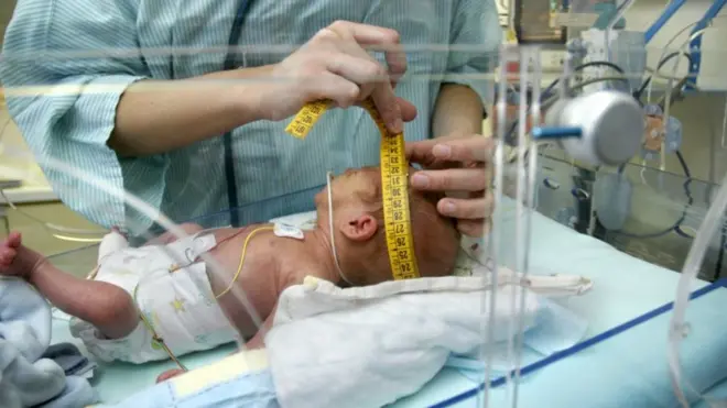 أصغر جهاز في العالم لتصوير "أدمغة الأطفال"