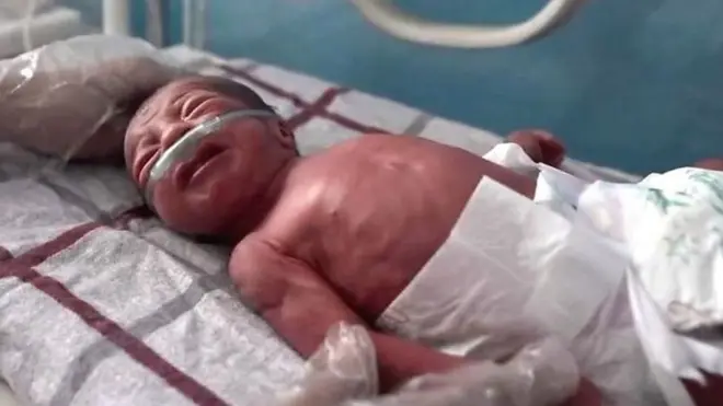 الأطفال حديثو الولادة يناضلون من أجل البقاء في أفغانستان