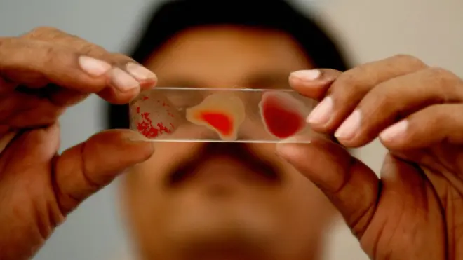 గర్భిణికి HIV రక్తం: నేరం ఎవరిది? బ్లడ్ బ్యాంక్‌దా? రక్తం ఇచ్చిన 19 ఏళ్ల కుర్రాడిదా?