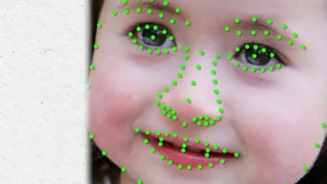 Диагноз по фото: нейросеть распознает генетические болезни