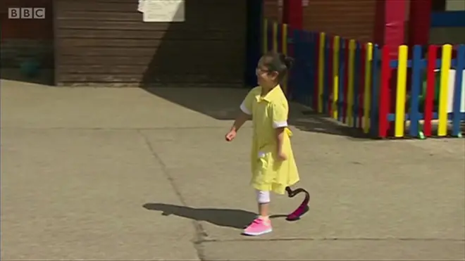 Новий протез