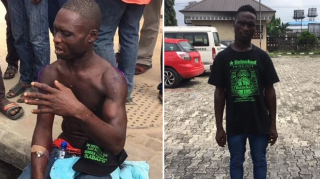 Etim Okon wen di building bin collapse (left) and how im look now