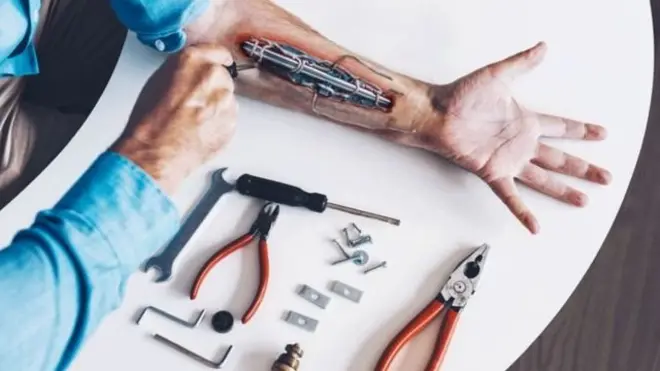 全球大約有10000人成為body hackers