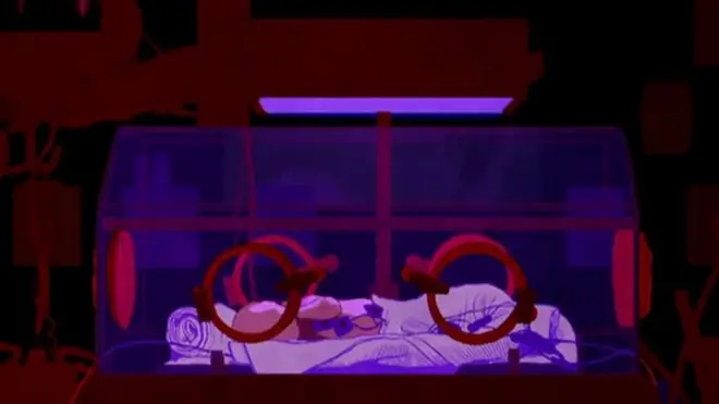 လမစေ့ခင်မွေးတဲ့ ကလေးတွေအတွက် သားအိမ်အတု