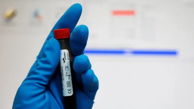 Образец крови