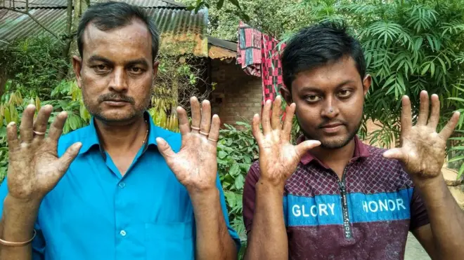 ኣማል ምስ ወዱ ኣፑ ሳርከር