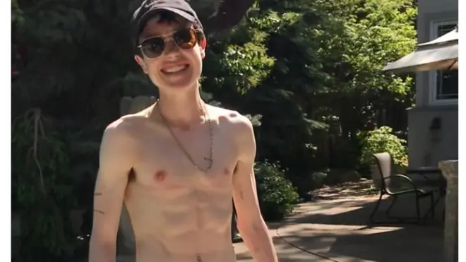 Elliot Page publicó su primera foto después de operarse el torso.