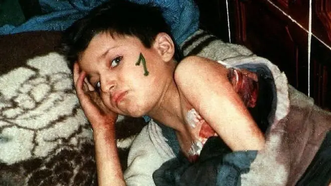 వేలాది మంది ఆకలితోనూ చనిపోయారు