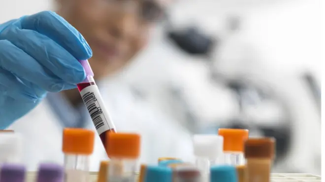 परीक्षण