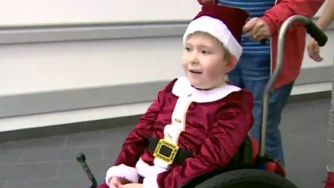 Ahora tiene el 80% de masa cerebral.