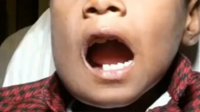 Mtoto huyo akiwa hospitali