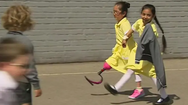 อานู ใส่ขาเทียมกีฬาเดินเล่นกับเพื่อน