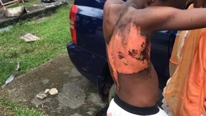 Nwata nwaanyị bu apa n'ahụ ya.