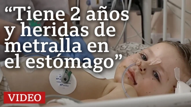Niño herido en Ucrania
