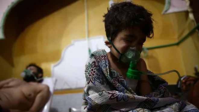 พลเรือนที่ได้รับบาดเจ็บจากการสู้รบในโรงพยาบาลแห่งหนึ่งของเมืองดูมา เขตโกตาตะวันออก