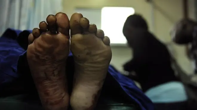 Chidozie say dem give am 8 drips in 48 hours wen test result neva come out