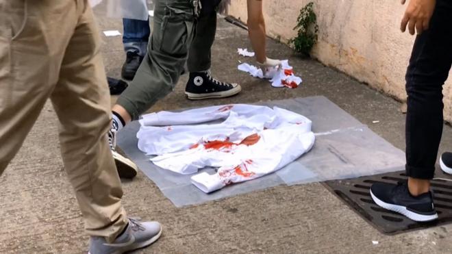 香港新界屯门码头亲北京议员何君尧遇袭现场警方探员检视一件染血衬衫（6/11/2019）