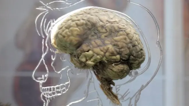 ยังไม่มีหลักฐานที่ชี้ว่า สามารถกู้ความทรงจำคืนกลับมาได้จากสมองที่ตายแล้ว