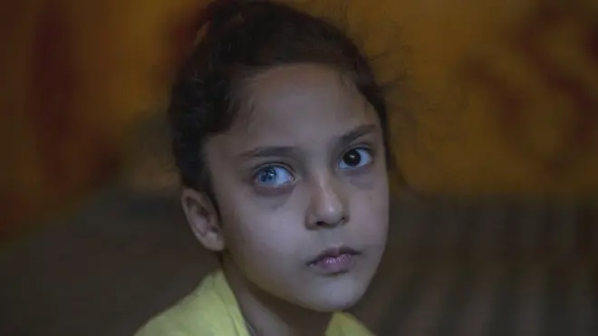 ’میں اپنی سکول کے سبق سب بھول گئی۔ میں سو فیصد نمبر حاصل کرتی تھی۔ جب میری آنکھ ٹھیک ہو گئی تو میں ڈاکٹر بننا چاہتی ہوں کیونکہ ڈاکٹروں نے میرا علاج کیا۔‘