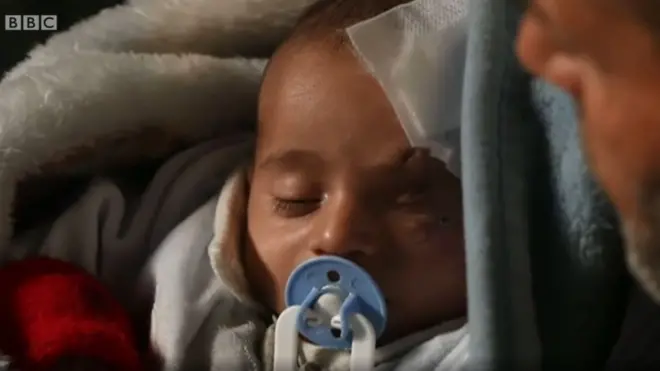 ብሓይልታት መንግስቲ ሶርያ ፀጋማይ ዓይኑ ዝተወቕዐ ወዲ ሰለስተ ወርሒ ህፃን ከሪም። ብዙሓት ሓደ ዓይኖም ብምሽፋን ነዚ ተግባር እናኾነንዎ እዮም።