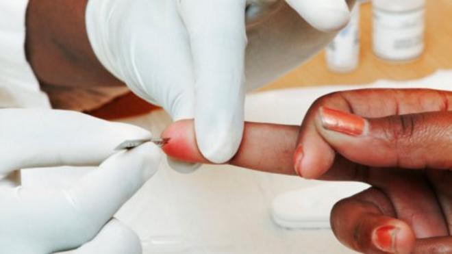 Le nouvel essai clinique représente un espoir dans la recherche d'un vaccin préventif contre le sida.