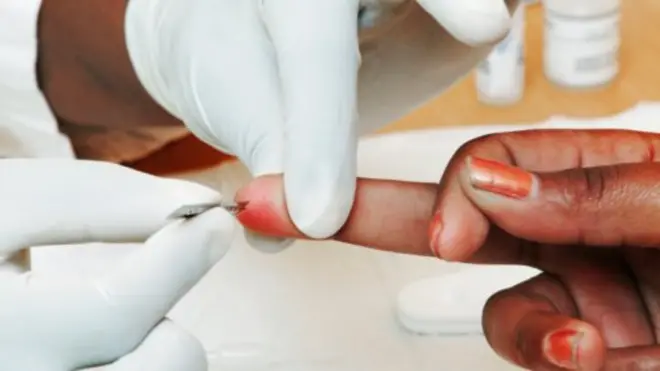 Le nouvel essai clinique représente un espoir dans la recherche d'un vaccin préventif contre le sida.